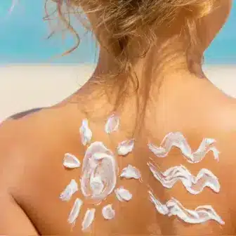 SONNENSCHUTZ